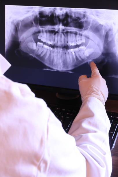 Best Chipped Tooth Repair Near Me  in Blue Point, NY